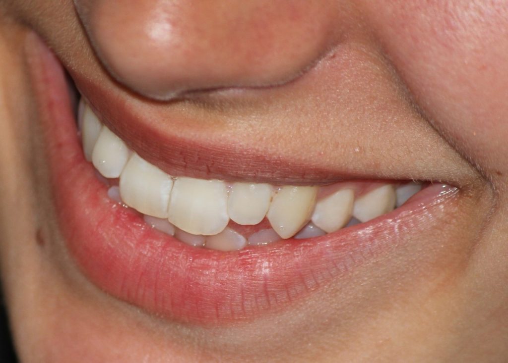 Pourquoi prendre soin de ses dents ?