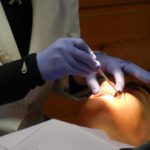 anesthésie chez le dentiste