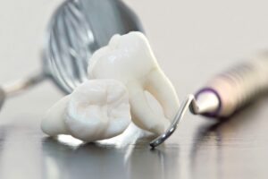Repas après extraction des dents de sagesse
